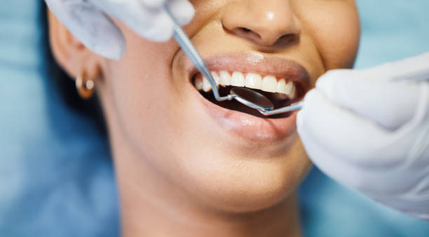 Best Chipped Tooth Repair Near Me  in Beach City, TX